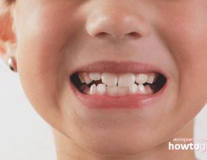 Как ребенку укрепить зубы Кальций для ребенка