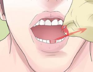 Как быстро и безболезненно вырвать зуб в домашних условиях
