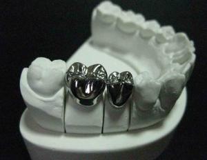 What and why crowns are best placed on chewing teeth